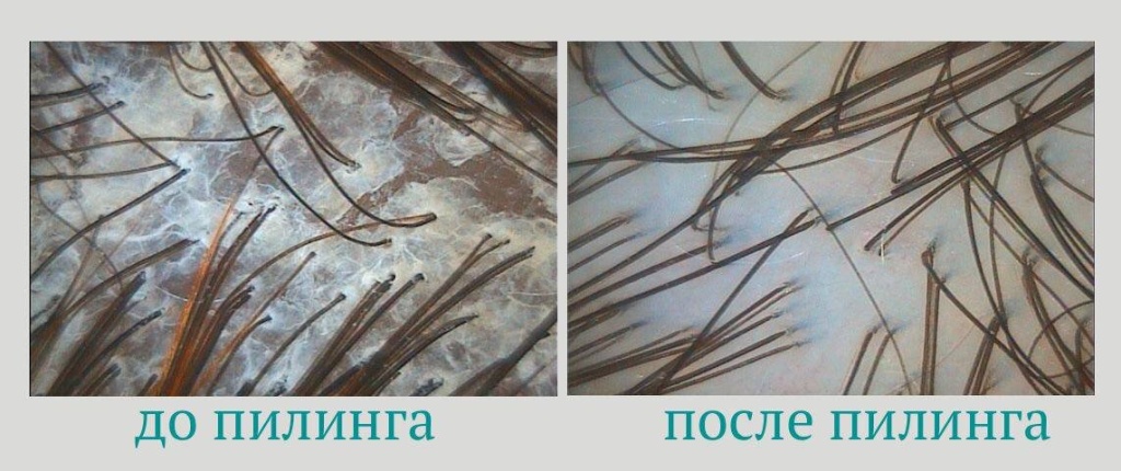 scale_1200.jpg