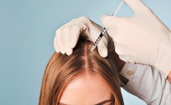 Мезотерапия волосистой части головы 